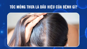 toc-mong-thua