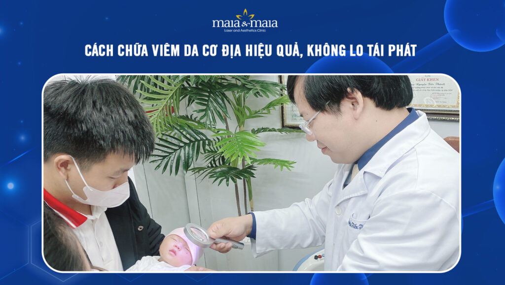Cách chữa viêm da cơ địa hiệu quả, không lo tái phát