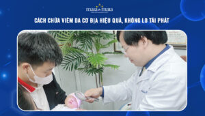 Cách chữa viêm da cơ địa hiệu quả, không lo tái phát