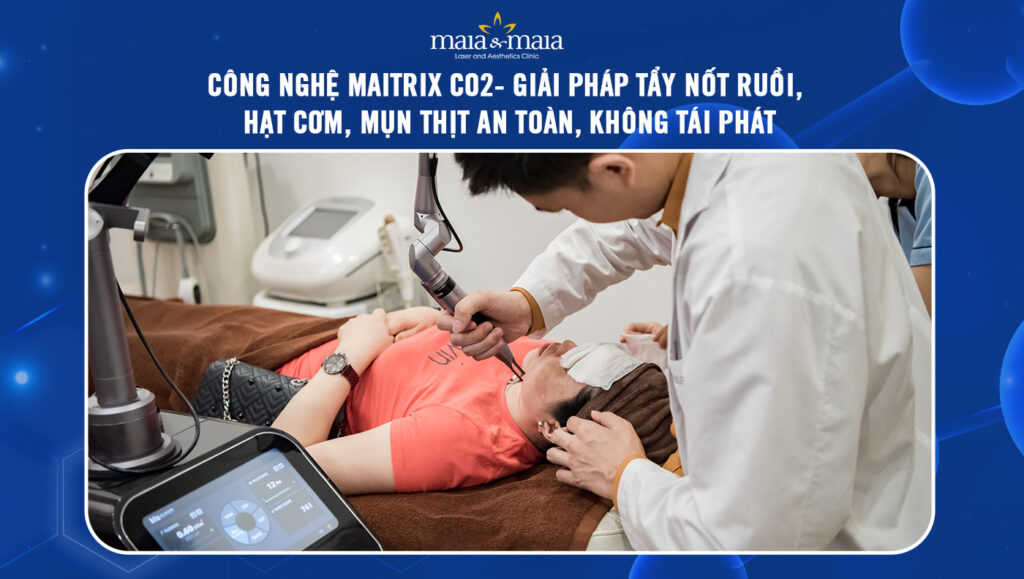Công nghệ Maitrix CO2- Giải pháp tẩy nốt ruồi, hạt cơm, mụn thịt an toàn, không tái phát