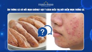 Ăn trứng cá có nổi mụn không