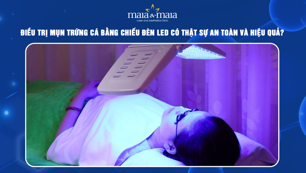 điều trị mụn trứng cá bằng chiếu đèn led