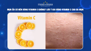 mụn ẩn có nên dùng vitamin c
