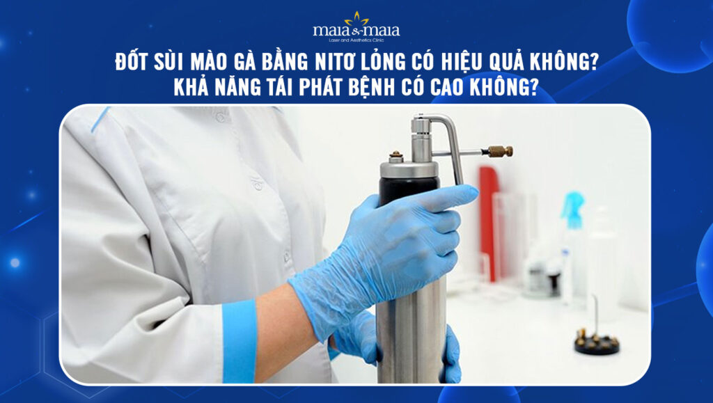đốt sùi mào gà bằng nitơ lỏng