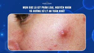 mụn bọc