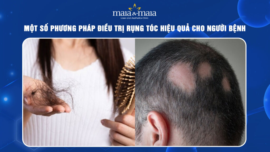 rụng tóc