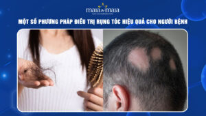 rụng tóc