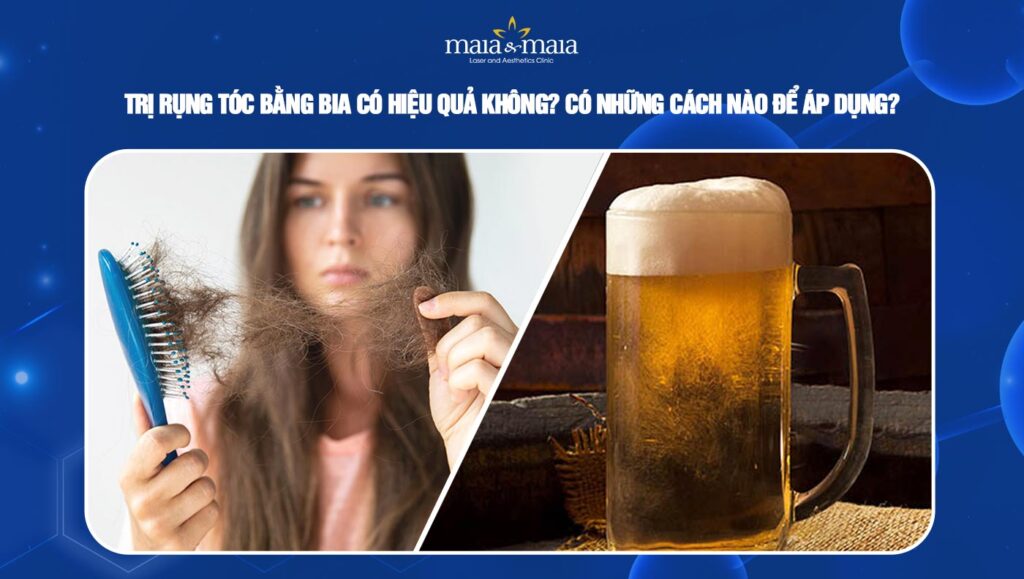 trị rụng tóc bằng bia