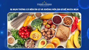 bị mụn trứng cá nên ăn gì