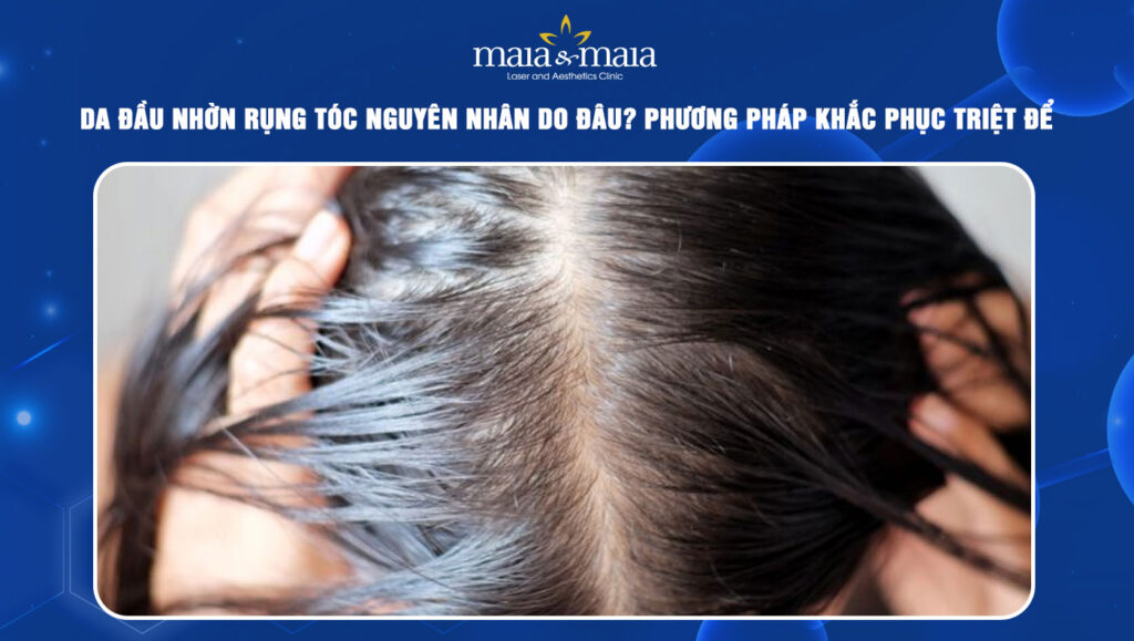 da đầu nhờn rụng tóc