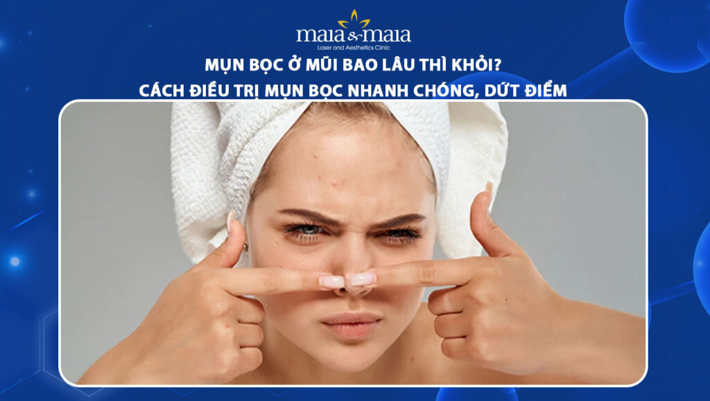 mụn bọc ở mũi bao lâu thì khỏi