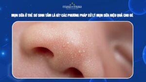 mụn sữa ở trẻ sơ sinh tắm lá gì
