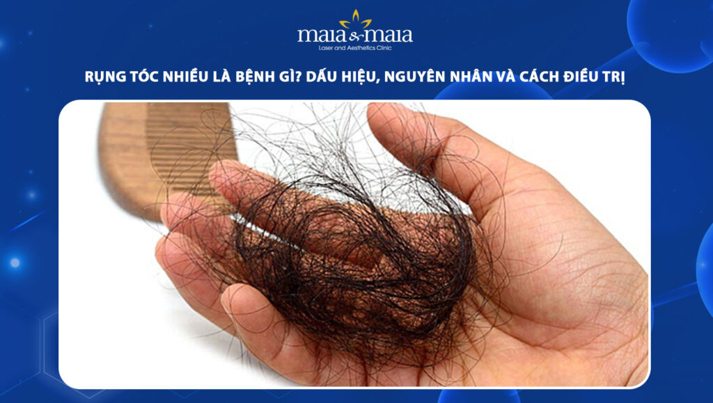 rụng tóc nhiều