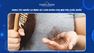 Rụng tóc nhiều là bệnh gì