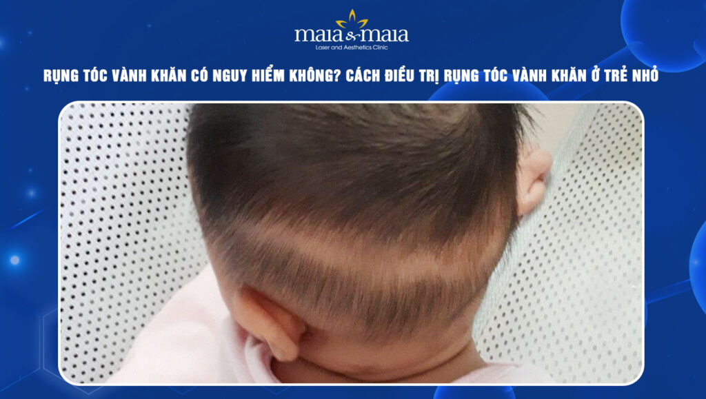 rụng tóc vành khăn có nguy hiểm không