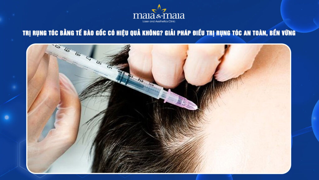 trị rụng tóc bằng tế bào gốc