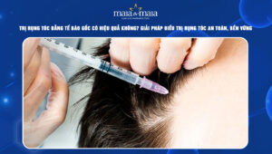trị rụng tóc bằng tế bào gốc
