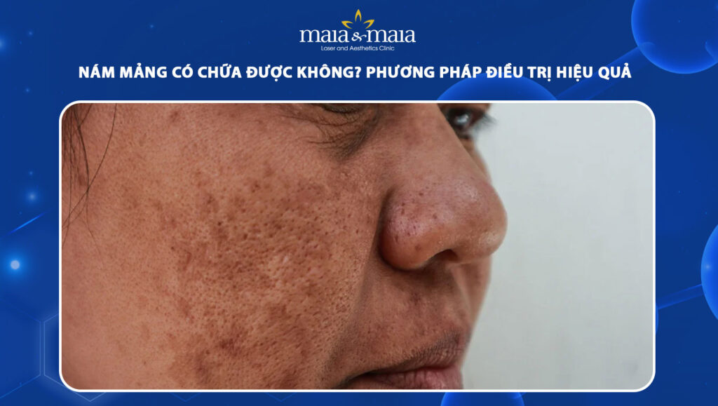 nám mảng