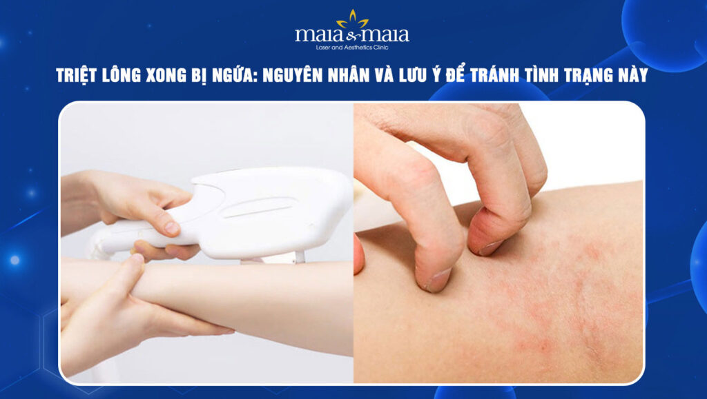 triệt lông xong bị ngứa