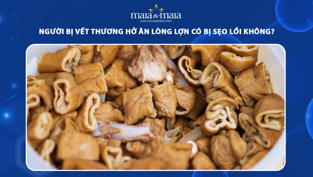 ăn lòng lợn có bị sẹo lồi không