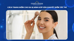 cách trang điểm cho da bị nám