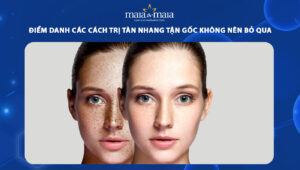 cách trị tàn nhang tận gốc