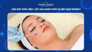 cấy collagen tươi có hết nám không