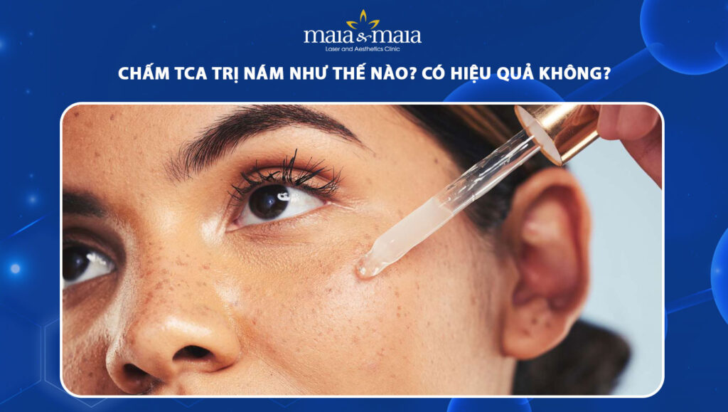 chấm tca trị nám