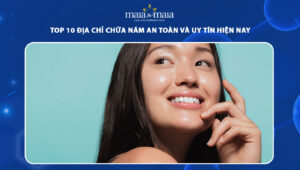 địa chỉ chữa nám