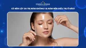 lột da trị nám