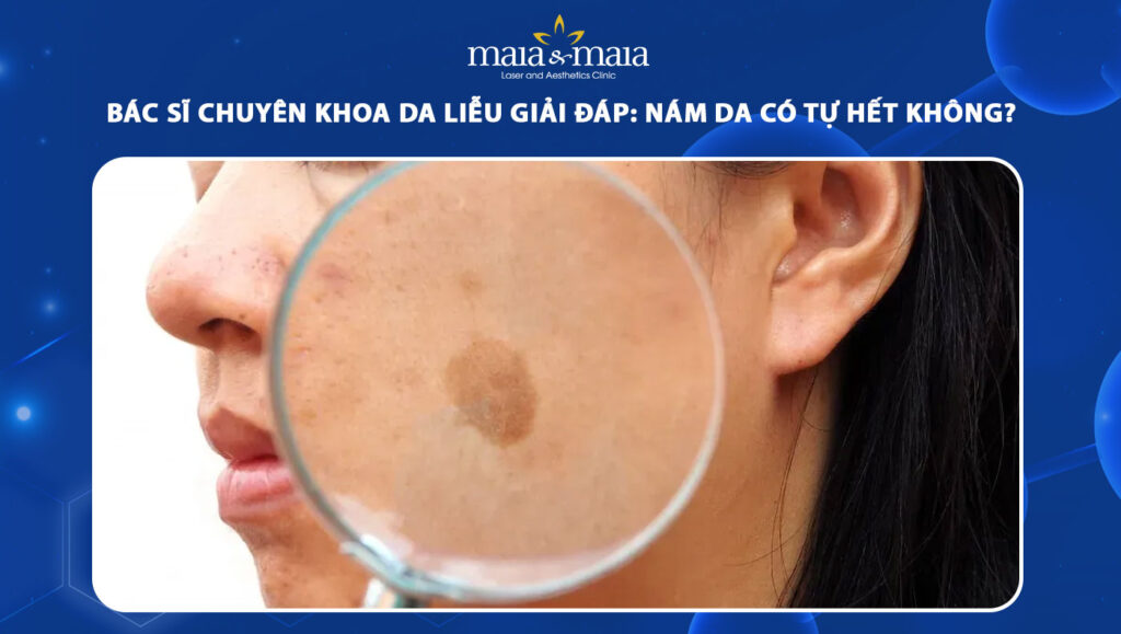 nám da có tự hết không