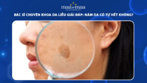 nám da có tự hết không