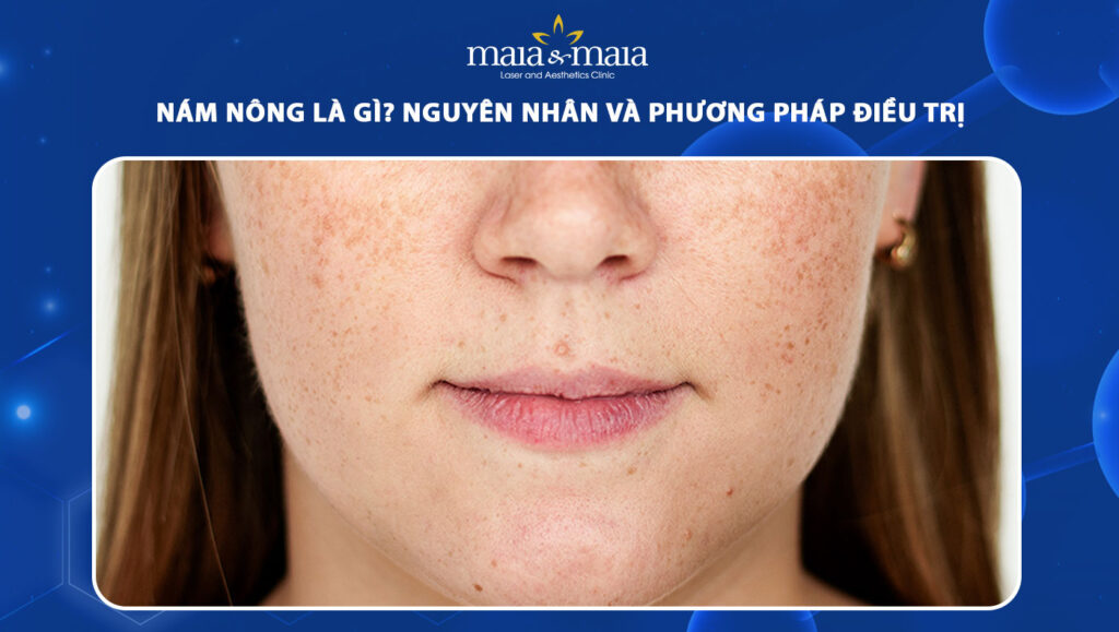 nám nông
