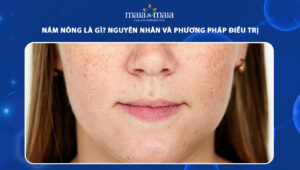 nám nông