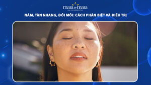 nám, tàn nhang, đồi mồi