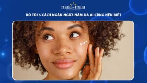 ngăn ngừa nám da