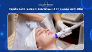 trị nám bằng laser co2 fractional