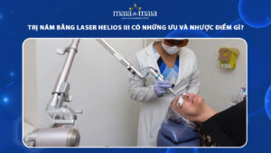 trị nám bằng laser helios III