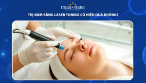 trị nám bằng laser toning