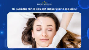 trị nám bằng prp