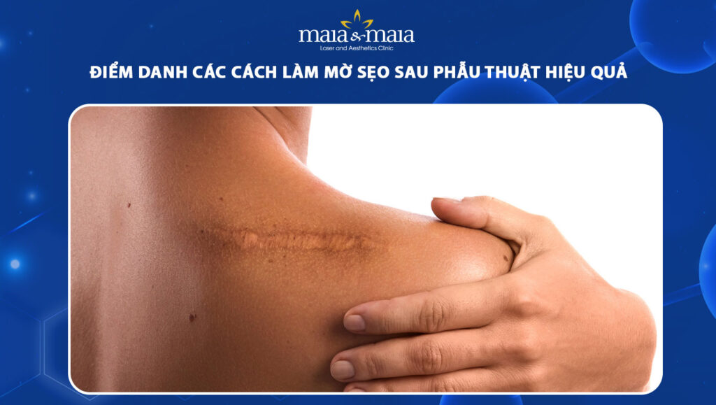 cách làm mờ sẹo sau phẫu thuật