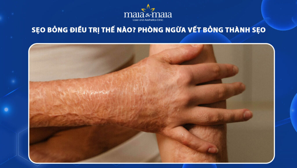 sẹo bỏng