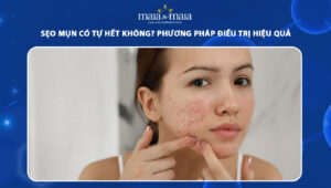 sẹo mụn