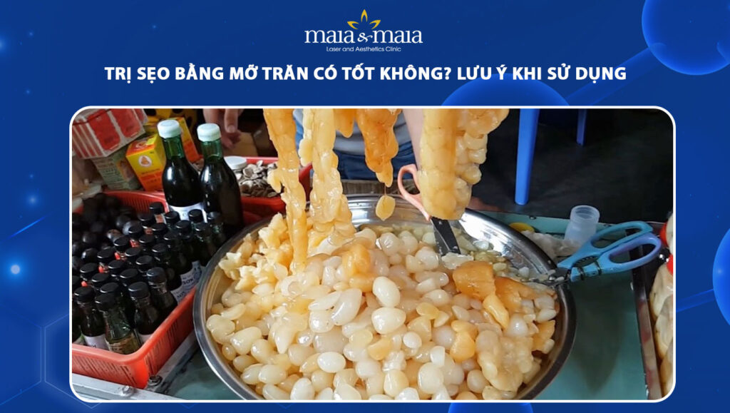 trị sẹo bằng mỡ trăn