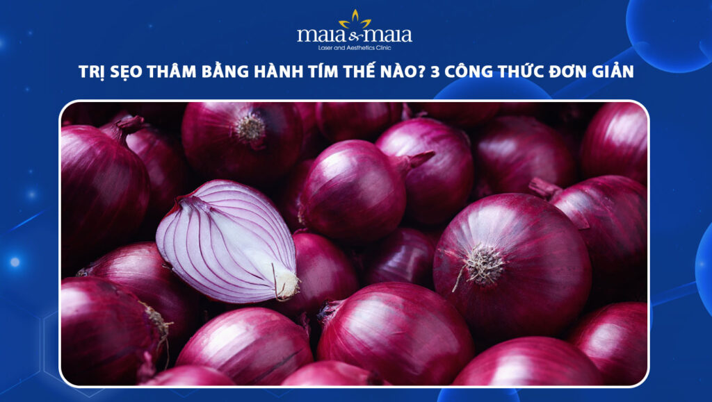 trị sẹo thâm bằng hành tím