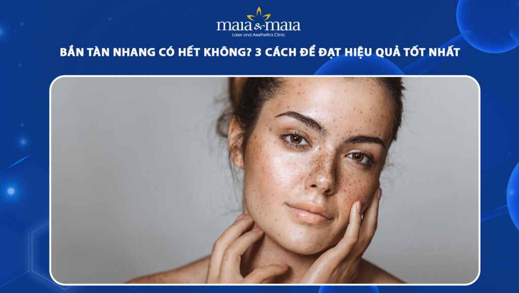 bắn tàn nhang có hết không