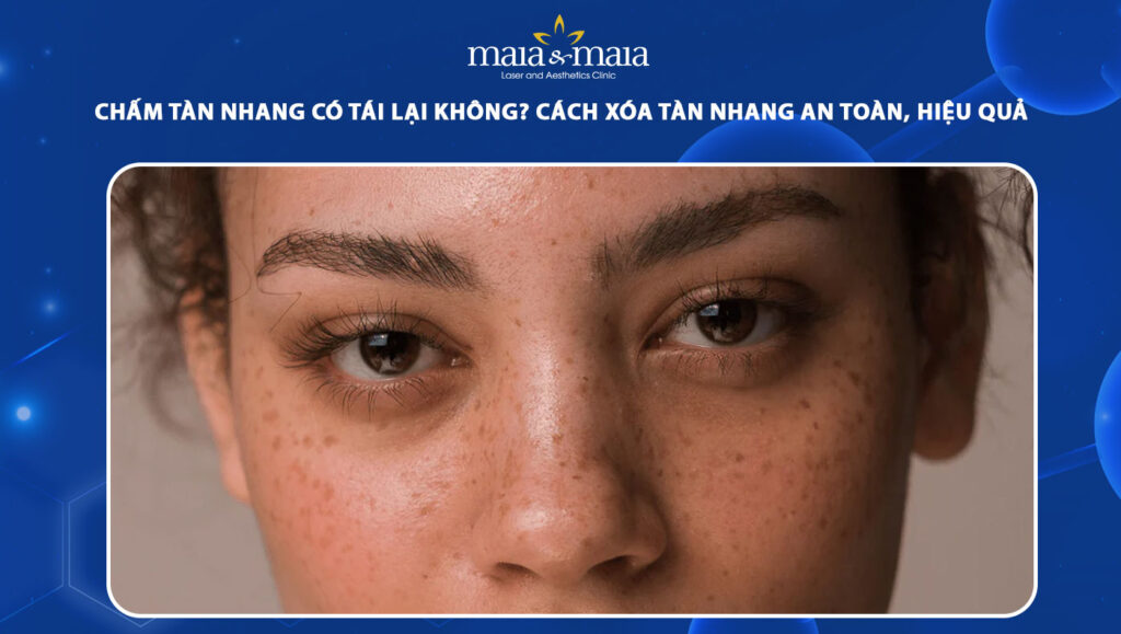 chấm tàn nhang