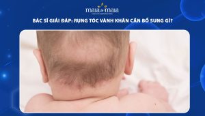 rụng tóc vành khăn cần bổ sung gì