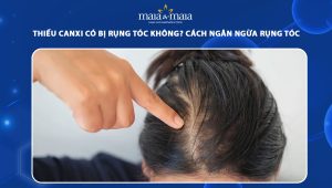 thiếu canxi có bị rụng tóc không