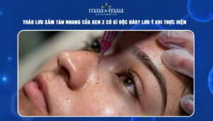 xăm tàn nhang